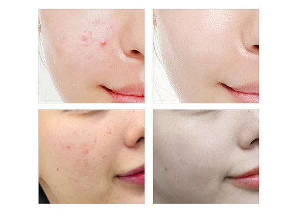 Serum Antioxidante Rejuvenescedor PREMIUM + ENVIO GRATIS